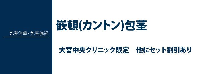 方形 と は カントン