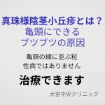 真珠様陰茎小丘疹とは亀頭にできるブツブツの原因と治療