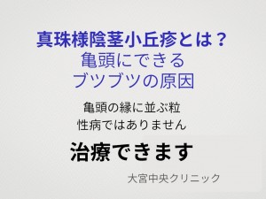 真珠様陰茎小丘疹とは亀頭にできるブツブツの原因と治療