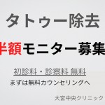 男性のタトゥー除去モニター募集 半額 大宮中央クリニック