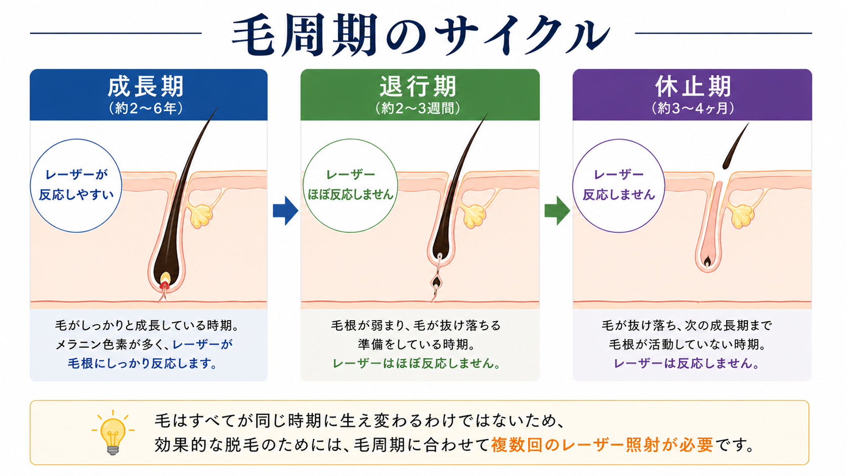 男性医療レーザー脱毛における毛周期のサイクル 成長期 退行期 休止期の説明