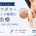 40代男性の首イボ 首のポツポツ・茶色いイボ除去 大宮中央クリニックメンズ